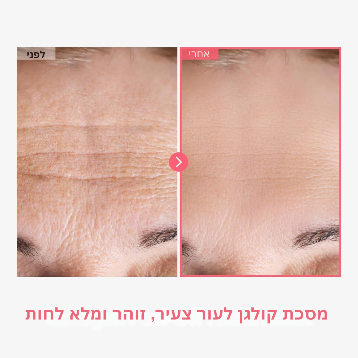 השפעת סרום חומצה היאלורונית על העור